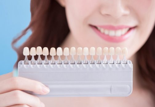Modern Lingual Braces Hawthorn – Straight Teeth without the Metal